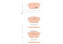 Front brake pad set
